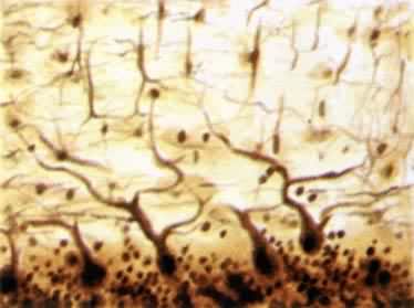 扇形树突神经元